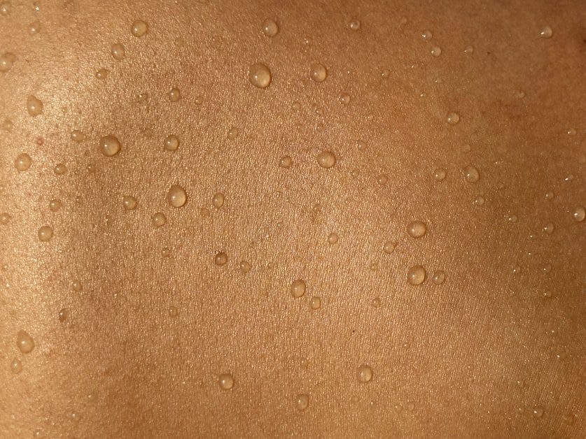 Skin Tags, Darkened Skin Patches, and Acne That Shifts - early signs of insulin resistance in women