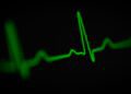 heart palpitations in perimenopause - Heart Palpitations in Perimenopause: When to Worry (and When It's Just Hormones)