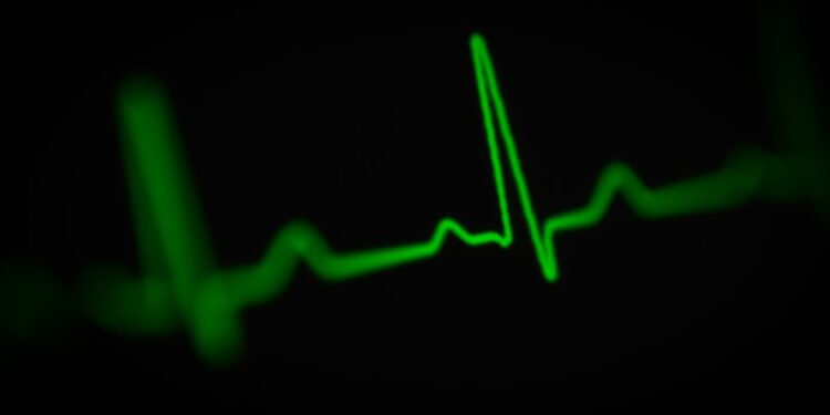 heart palpitations in perimenopause - Heart Palpitations in Perimenopause: When to Worry (and When It's Just Hormones)