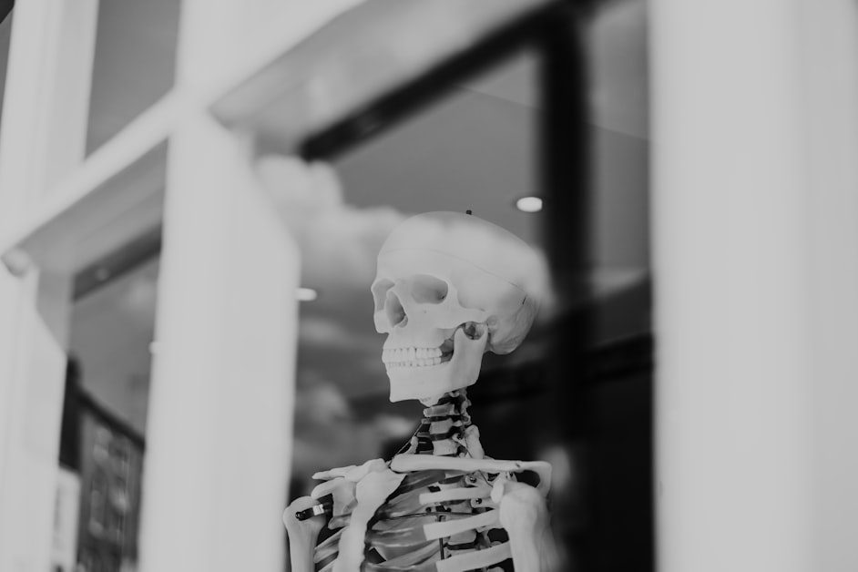 The Bone Loss Window You Cannot See While You Are Inside It - lifting heavy in perimenopause