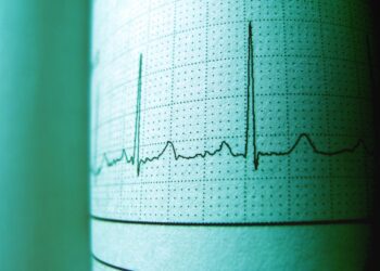 resting heart rate in perimenopause - Resting Heart Rate in Perimenopause: What's Normal and What's Not