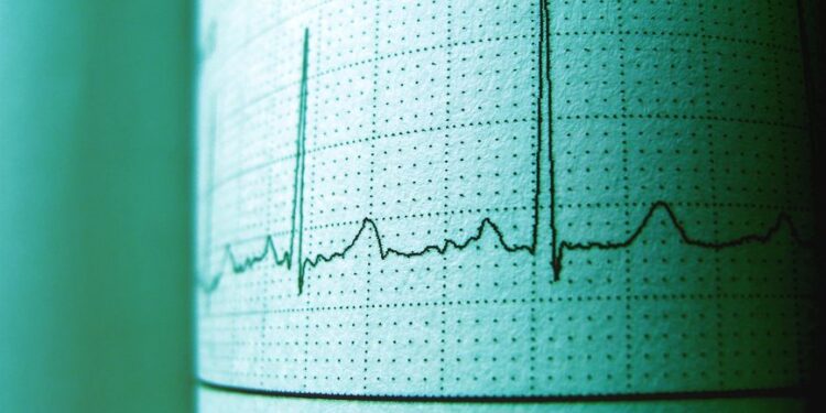 resting heart rate in perimenopause - Resting Heart Rate in Perimenopause: What's Normal and What's Not