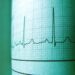 resting heart rate in perimenopause - Resting Heart Rate in Perimenopause: What's Normal and What's Not