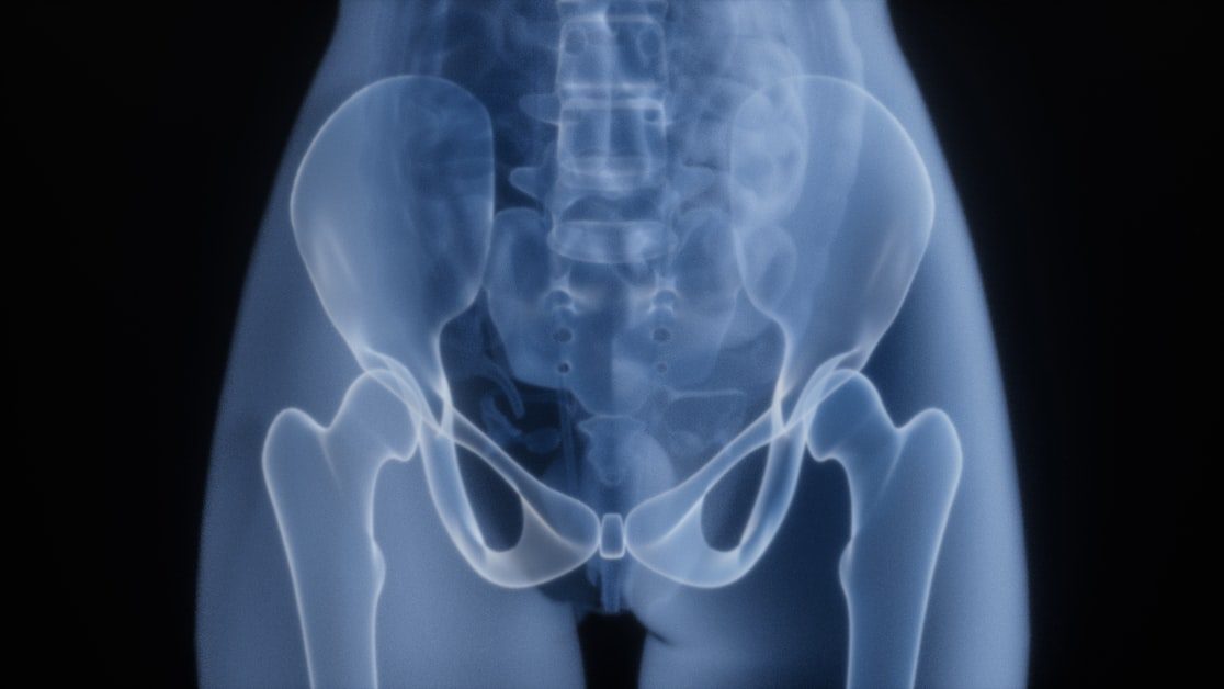 What Sacroiliac Joint Pain Actually Is - sacroiliac joint pain exercises