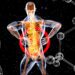 herniated disc back pain - Herniated Disc Back Pain: Causes, Symptoms, and Relief