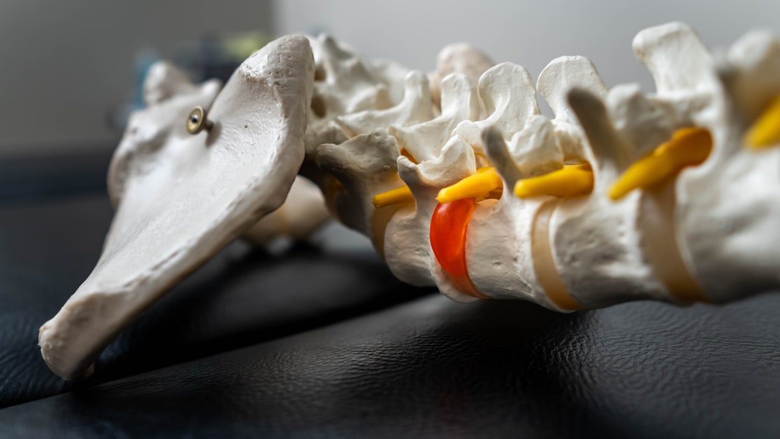 What Causes Herniated Disc Back Pain - herniated disc back pain