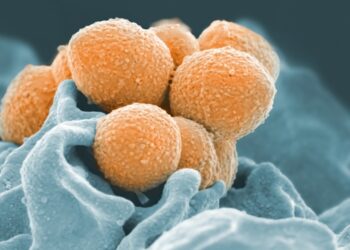 common bacterial diseases - 12 Bacterial Diseases You Didn't Know You Could Ge
