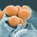 common bacterial diseases - 12 Bacterial Diseases You Didn't Know You Could Ge