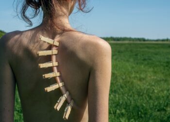 mechanical back problems - Are You Suffering from Mechanical Back Pain or Ser