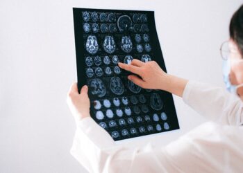 signs your brain needs care - 7 Signs It's Time To Nurture Your Brain