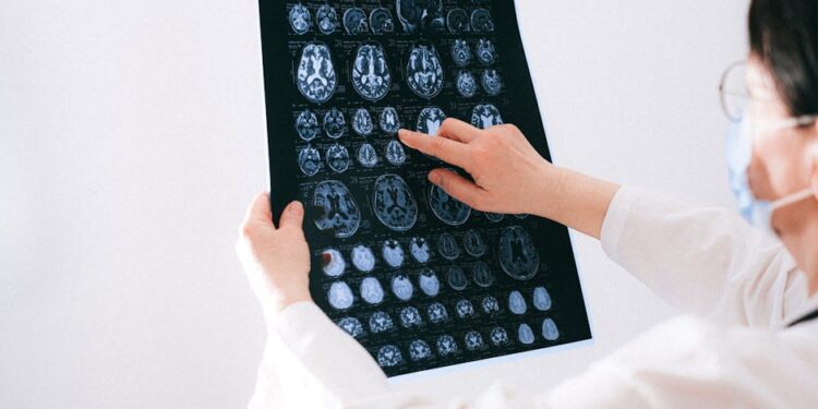 signs your brain needs care - 7 Signs It's Time To Nurture Your Brain