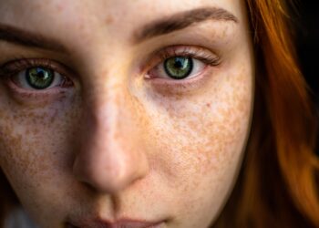 types of acne - 4 Different Types of Acne and How to Treat Them