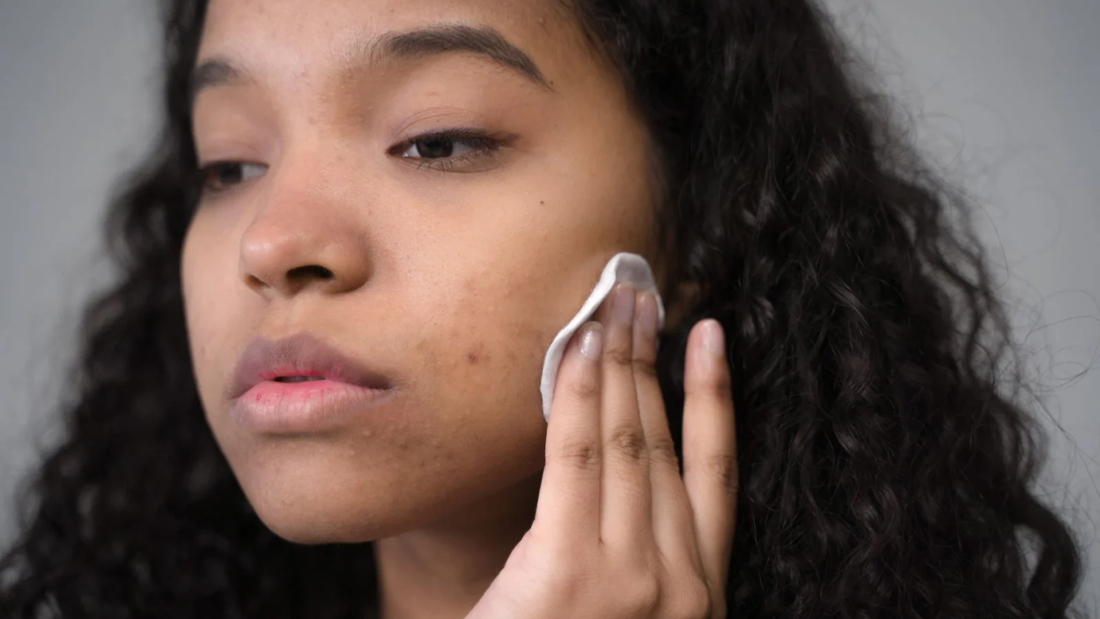 What Causes Dark Spots on Your Face? - how to get rid of dark spots on face naturally