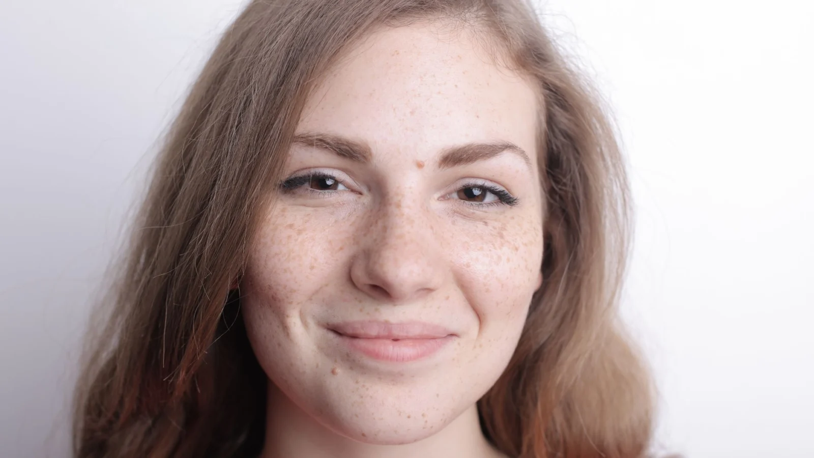 4 Types of Dark Spots You Need to Identify First - how to get rid of dark spots on face naturally