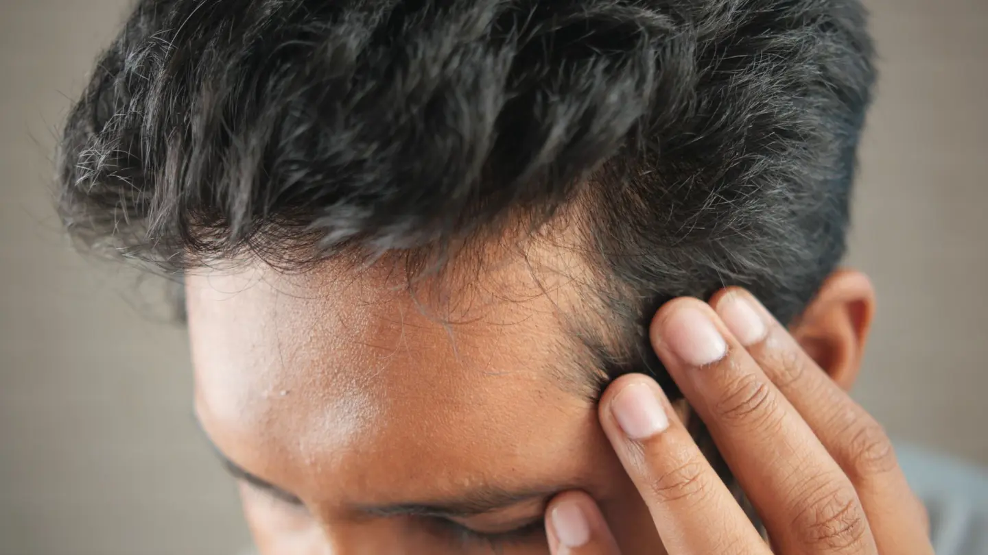 Can vitamin d deficiency cause hair thinning: close-up of a man's hand touching his head in contemplation