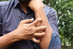 Perimenopause skin itching: a man in a blue shirt scratching his arm outdoors, highlighting skin irritation