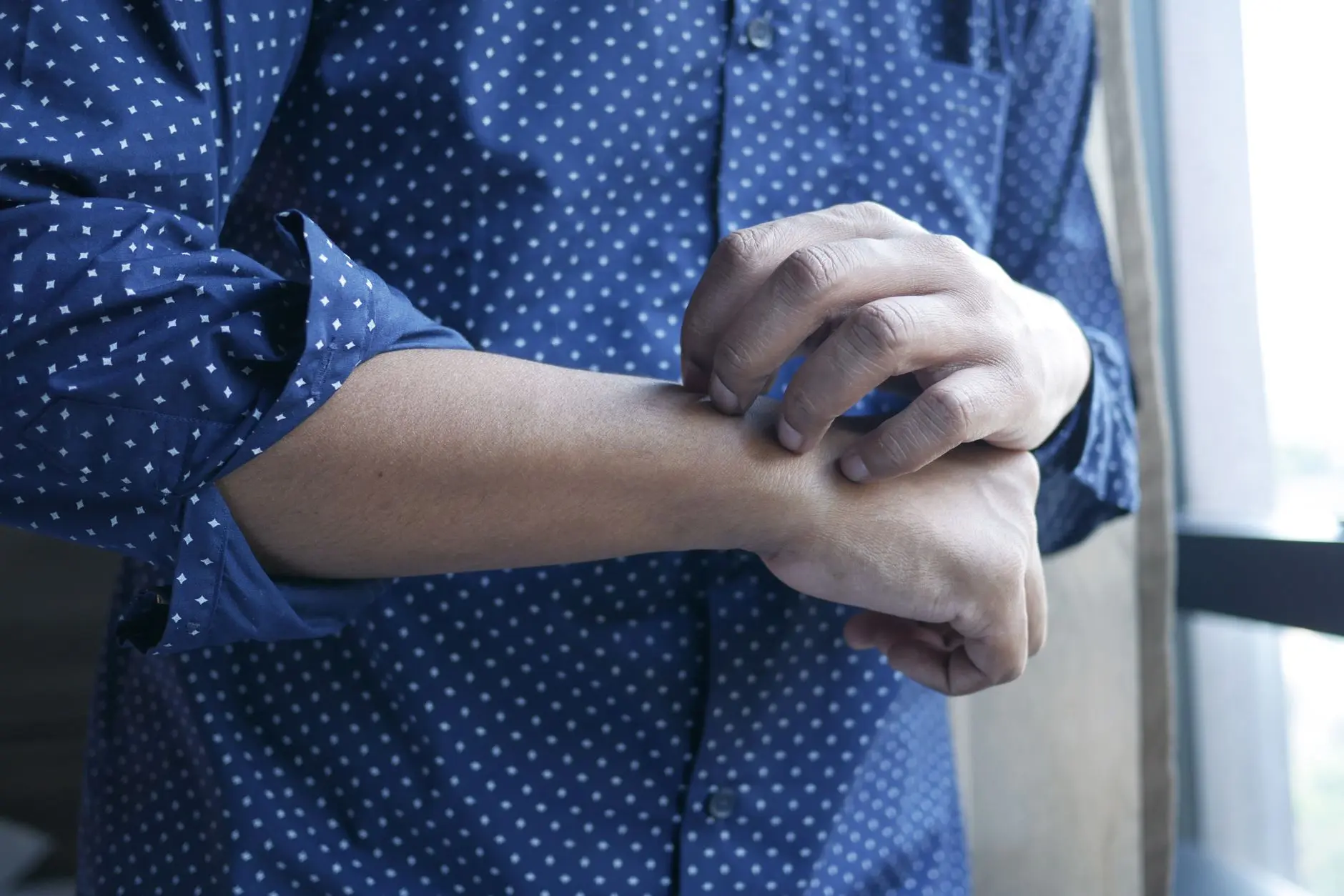 A man in a polka dot shirt scratching his arm next to a window, symbolizing discomfort or irritation