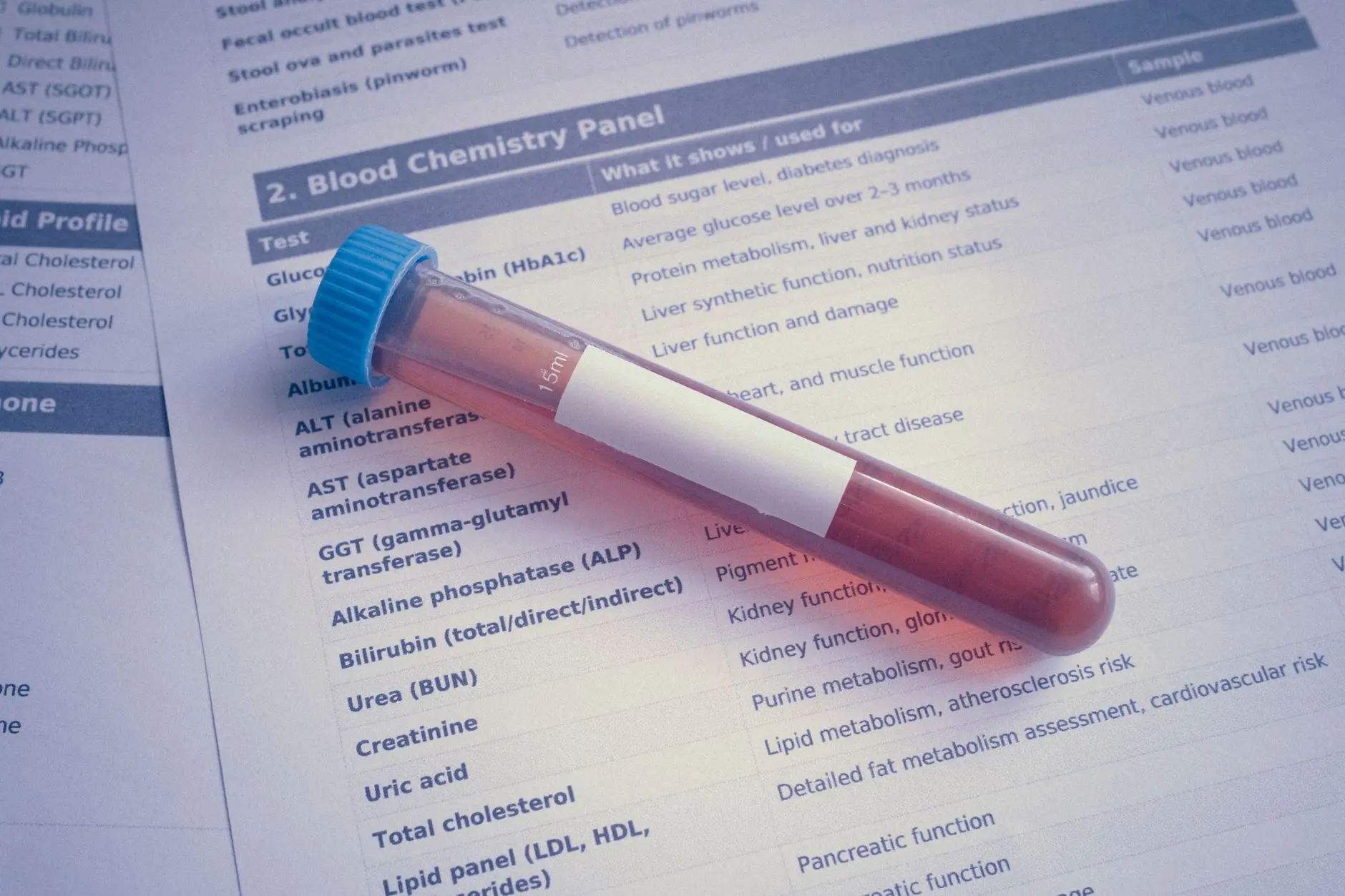 A blood sample tube placed on a chemistry panel document, showcasing medical testing