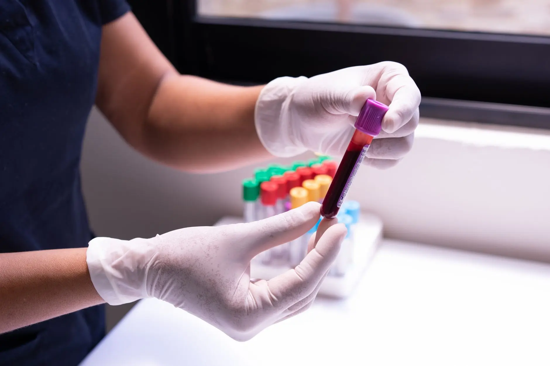 Gloved hands carefully handling a blood sample in a medical or laboratory environment